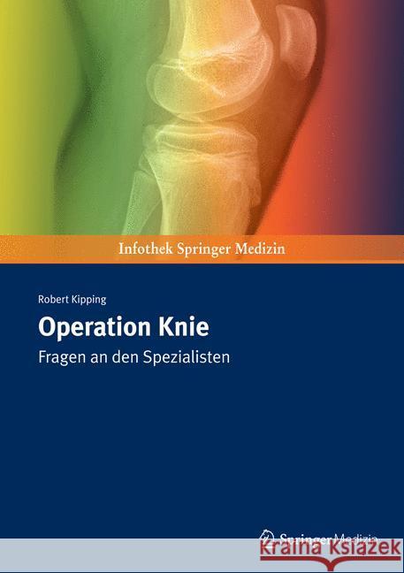 Operation Knie: Fragen an Den Spezialisten Kipping, Robert 9783899353174 Springer - książka