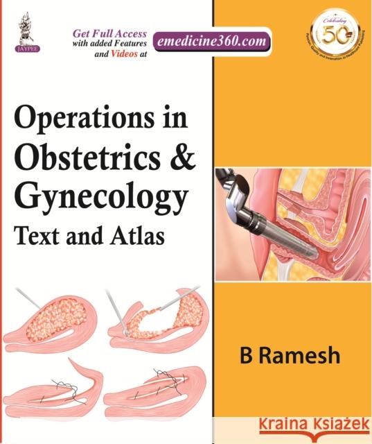 Operations in Obstetrics & Gynecology: Text and Atlas B Ramesh   9789389776720 Jaypee Brothers Medical Publishers - książka