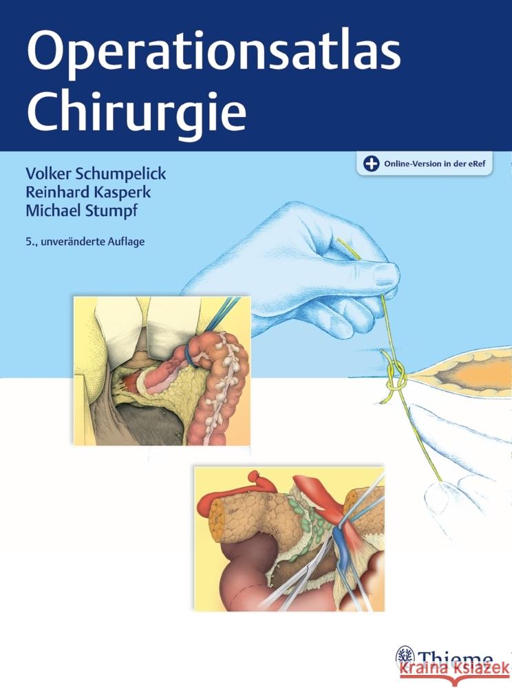 Operationsatlas Chirurgie Schumpelick, Volker; Kasperk, Reinhard; Stumpf, Michael 9783132438477 Thieme, Stuttgart - książka