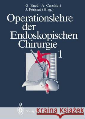 Operationslehre Der Endoskopischen Chirurgie 1: Band 1 Bueß, Gerhard 9783642782879 Springer - książka