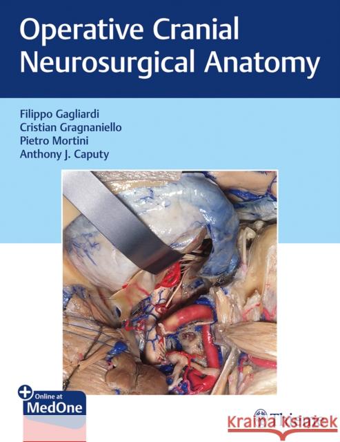 Operative Cranial Neurosurgical Anatomy Filippo Gagliardi Cristian Gragnaniello Pietro Mortini 9781626232167 Thieme Medical Publishers - książka