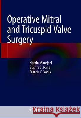 Operative Mitral and Tricuspid Valve Surgery Narain Moorjani Francis Wells 9781447142034 Springer - książka