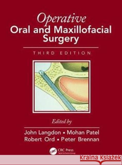 Operative Oral and Maxillofacial Surgery John D. Langdon Mohan F. Patel Robert Ord 9781482252040 CRC Press - książka