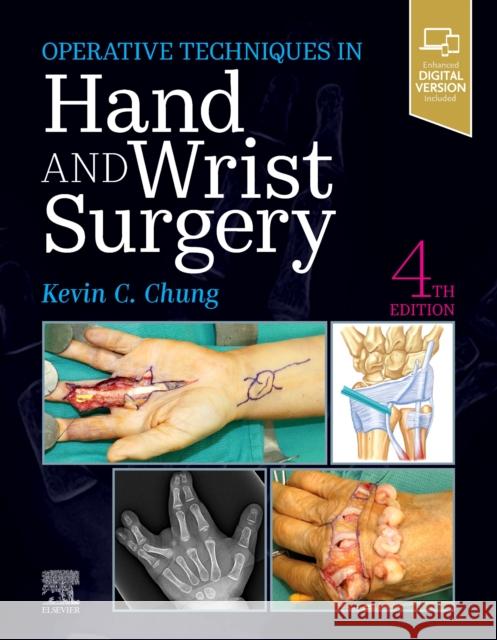 Operative Techniques: Hand and Wrist Surgery Kevin C. Chung 9780323794152 Elsevier - Health Sciences Division - książka