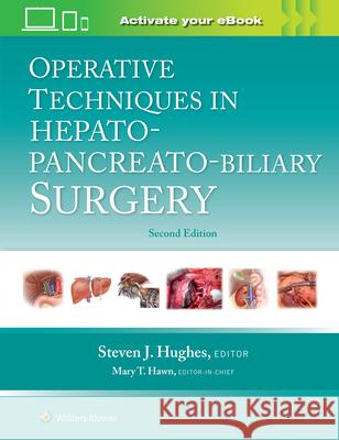 Operative Techniques in Hepato-Pancreato-Biliary Surgery Steven Hughes 9781975176587 Wolters Kluwer Health - książka