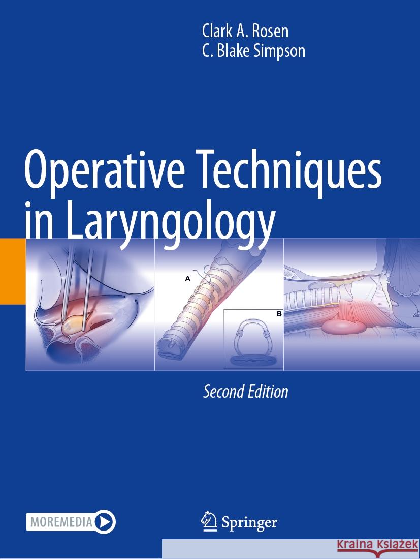 Operative Techniques in Laryngology Clark a. Rosen C. Blake Simpson 9783031343568 Springer - książka