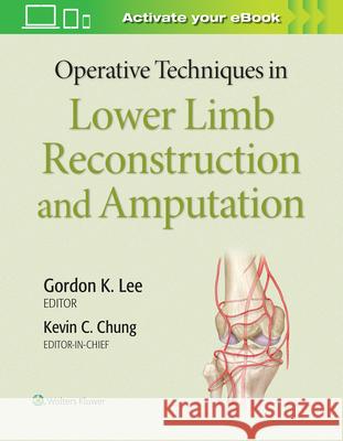 Operative Techniques in Lower Limb Reconstruction and Amputation Chung, Kevin C. 9781975127343 LWW - książka