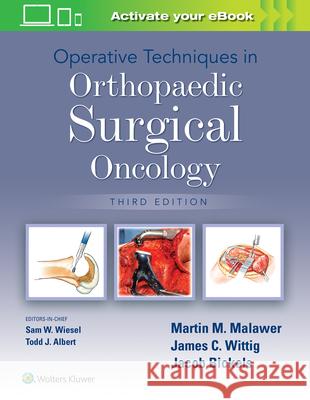 Operative Techniques in Orthopaedic Surgical Oncology Martin M. Malawer 9781975172084 LWW - książka