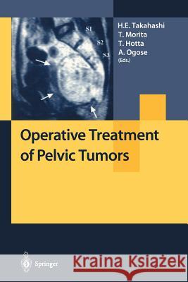Operative Treatment of Pelvic Tumors H. E. Takahashi T. Morita T. Hotta 9784431668671 Springer - książka