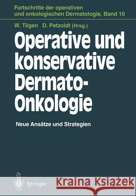 Operative Und Konservative Dermato-Onkologie: Neue Ansätze Und Strategien Tilgen, Wolfgang 9783642793370 Springer - książka