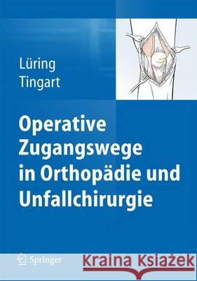 Operative Zugangswege in Orthopädie Und Unfallchirurgie Lüring, Christian 9783642382642 Springer - książka