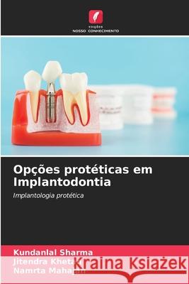 Opções protéticas em Implantodontia sharma, Kundanlal, KHETAN, JITENDRA, MAHAJAN, NAMRTA 9786202421447 Edições Nosso Conhecimento - książka