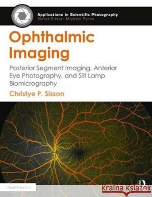 Ophthalmic Imaging: Posterior Segment Imaging, Anterior Eye Photography, and Slit Lamp Biomicrography Peres, Michael 9781138886001  - książka