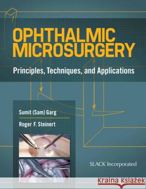 Ophthalmic Microsurgery: Principles, Techniques, and Applications Garg, Sumit 9781617110450 Slack - książka
