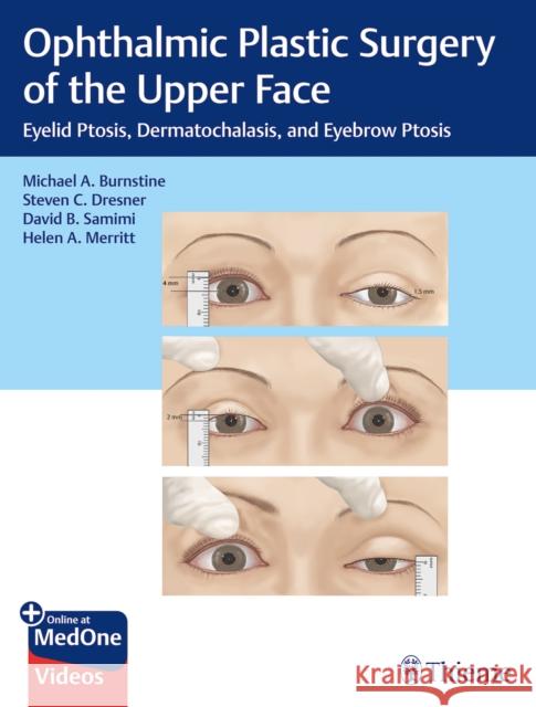 Ophthalmic Plastic Surgery of the Upper Face: Eyelid Ptosis, Dermatochalasis, and Eyebrow Ptosis Burnstine, Michael A. 9781626239210 Thieme Medical Publishers - książka