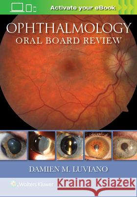 Ophthalmology Oral Board Review Damien M. Luviano 9781496340115 LWW - książka