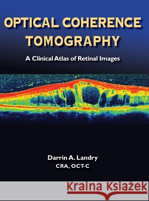 Optical Coherence Tomography A. Landry Darrin 9780988294035 Bryson Taylor Publishing - książka