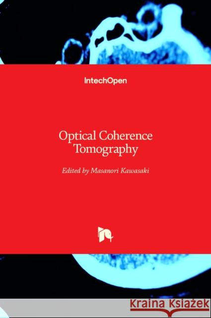 Optical Coherence Tomography Masanori Kawasaki 9789535110323 Intechopen - książka