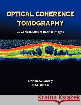 Optical Coherence Tomography a Clinical Atlas of Retinal Images Darrin A. Landry 9780984193448 Bryson Taylor Publishing - książka