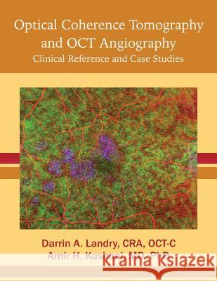 Optical Coherence Tomography and OCT Angiography: Clinical Reference and Case Studies Landry, Cra Oct 9780998386737 Bryson Taylor Publishing - książka