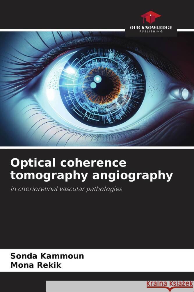 Optical coherence tomography angiography Sonda Kammoun Mona Rekik 9786208276058 Our Knowledge Publishing - książka