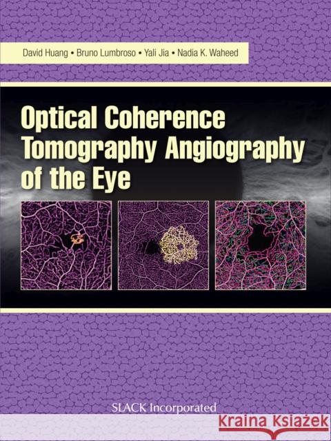 Optical Coherence Tomography Angiography of the Eye: Oct Angiography David Huang Bruno Lumbroso Yali Jia 9781630912826 Slack - książka