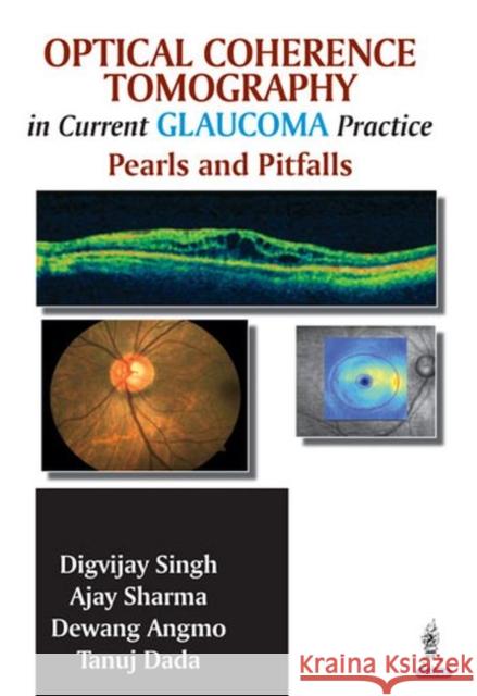 Optical Coherence Tomography in Current Glaucoma Practice: Pearls and Pitfalls Singh, Digvijay 9789351521884 Jp Medical Ltd - książka