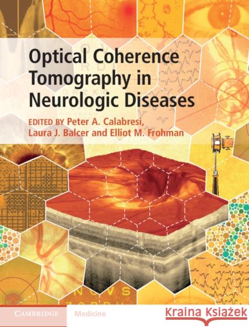 Optical Coherence Tomography in Neurologic Diseases Peter A. Calabresi Laura Balcer Elliot Frohman 9781107041301 Cambridge University Press - książka