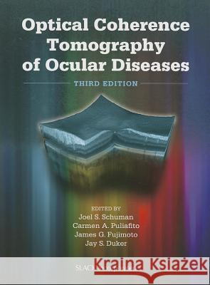 Optical Coherence Tomography of Ocular Diseases Joel S Schuman 9781556428647  - książka