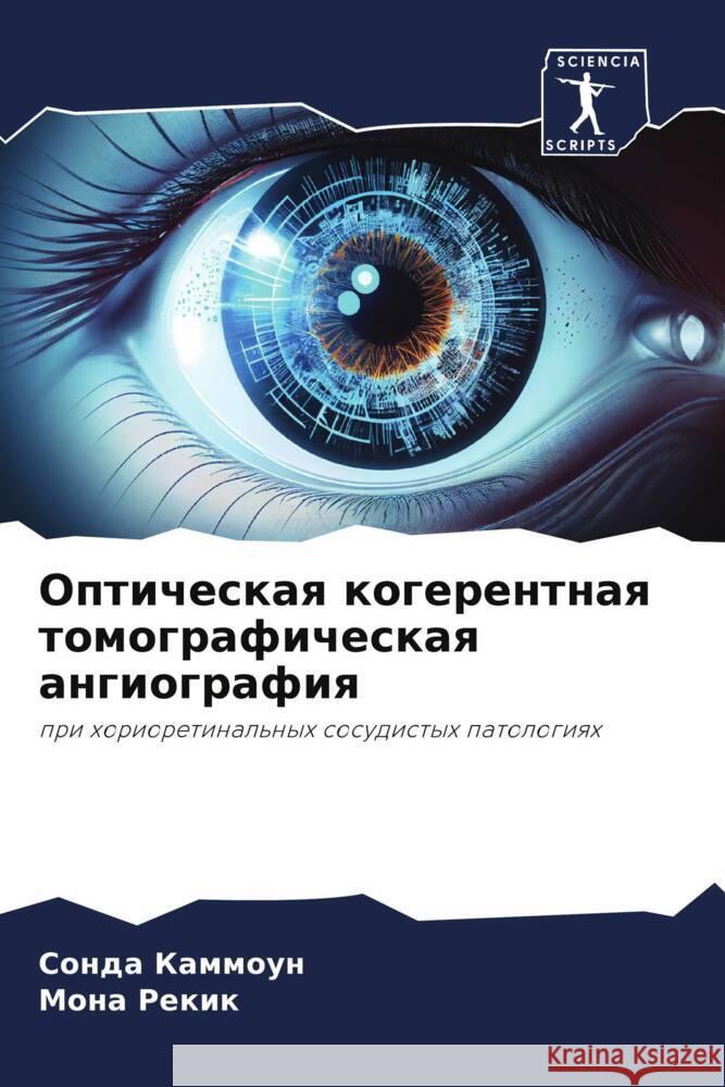 Opticheskaq kogerentnaq tomograficheskaq angiografiq KAMMOUN, Sonda, REKIK, Mona 9786208276096 Sciencia Scripts - książka