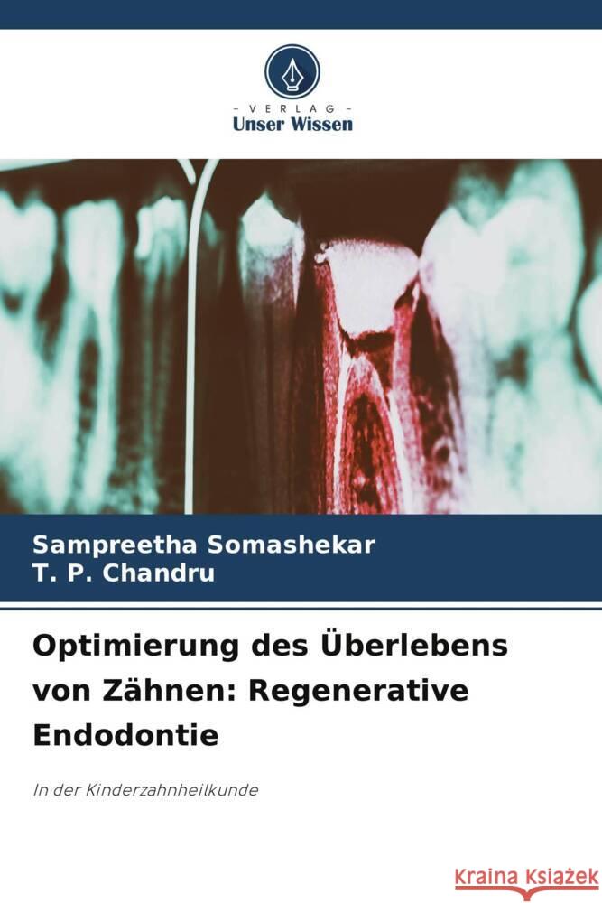 Optimierung des ?berlebens von Z?hnen: Regenerative Endodontie Sampreetha Somashekar T. P. Chandru 9786208107789 Verlag Unser Wissen - książka