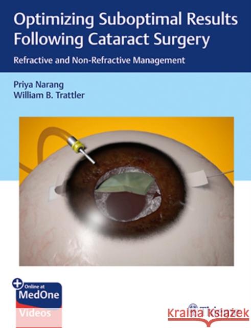 Optimizing Suboptimal Results Following Cataract Surgery: Refractive and Non-Refractive Management Priya Narang William Trattler 9781626238954 Thieme Medical Publishers - książka