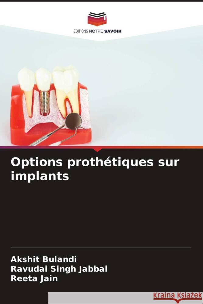 Options prothétiques sur implants Bulandi, Akshit, Jabbal, Ravudai Singh, Jain, Reeta 9786209461019 Editions Notre Savoir - książka