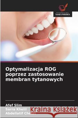 Optymalizacja ROG poprzez zastosowanie membran tytanowych Slim, Afef, Khelil, Sarra, Chokri, Abdellatif 9786208468613 Wydawnictwo Nasza Wiedza - książka