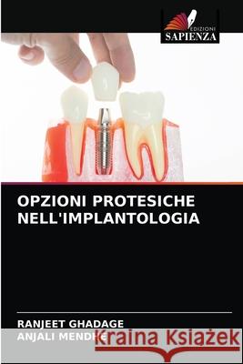 Opzioni Protesiche Nell'implantologia Ranjeet Ghadage, Anjali Mendhe 9786204036748 Edizioni Sapienza - książka