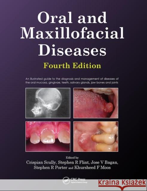 Oral and Maxillofacial Diseases, Fourth Edition Crispian Scully, CBE Stephen Flint  9780367446000 CRC Press - książka
