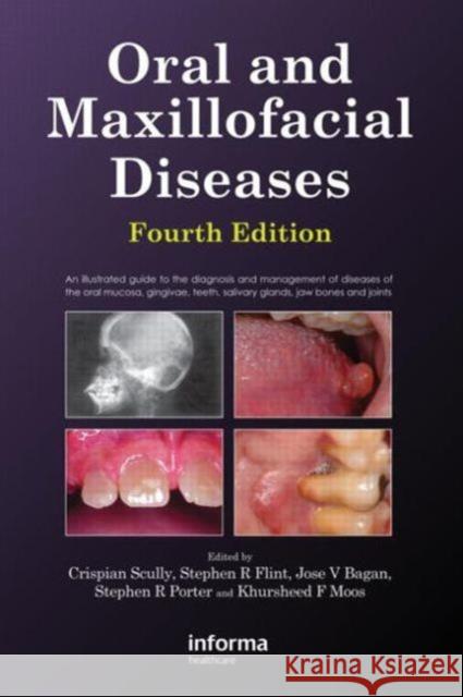 Oral and Maxillofacial Diseases, Fourth Edition Crispian Scully Stephen Flint Stephen R. Porter 9780415414944 Informa Healthcare - książka