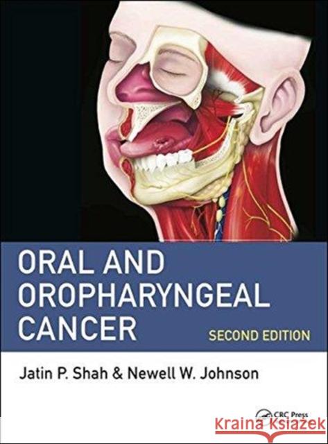 Oral and Oropharyngeal Cancer Jatin P. Sha Newell W. Johnso 9781498700085 CRC Press - książka