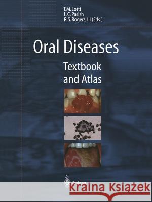 Oral Diseases: Textbook and Atlas Lotti, Torello M. 9783642641381 Springer - książka