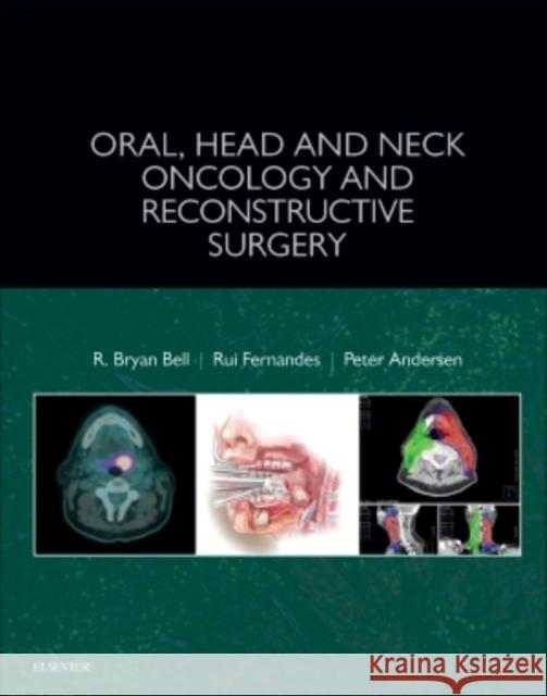 Oral, Head and Neck Oncology and Reconstructive Surgery R. Bryan Bell Peter A. Andersen Rui Fernandes 9780323265683 Elsevier - książka