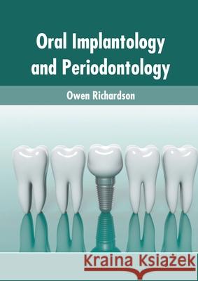 Oral Implantology and Periodontology Owen Richardson 9781639874156 Murphy & Moore Publishing - książka