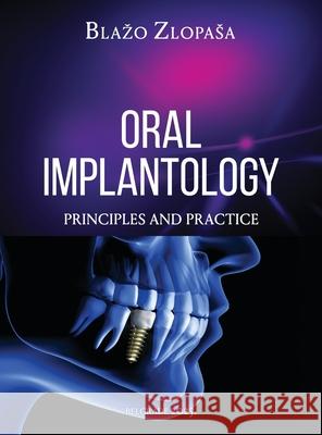 Oral Implantology: Principles and Practice Blazo Zlopasa 9781967421473 Blazo Zlopasa Publications - książka
