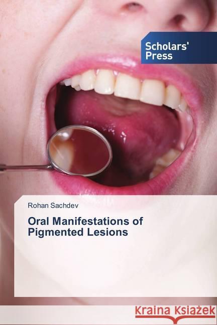 Oral Manifestations of Pigmented Lesions Sachdev, Rohan 9786202311991 Scholar's Press - książka