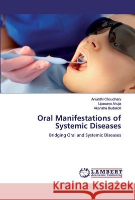 Oral Manifestations of Systemic Diseases Choudhary, Anuridhi 9786200315953 LAP Lambert Academic Publishing - książka