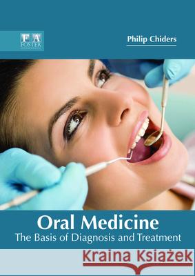 Oral Medicine: The Basis of Diagnosis and Treatment Philip Chiders 9781632425164 Foster Academics - książka