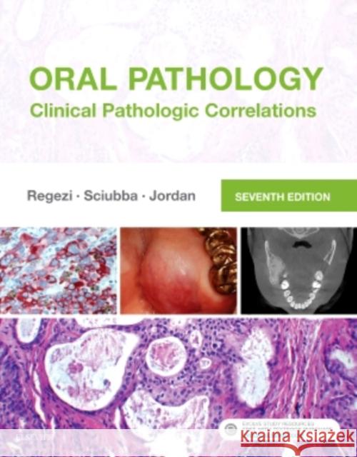 Oral Pathology: Clinical Pathologic Correlations Regezi, Joseph A. 9780323297684 Saunders - książka