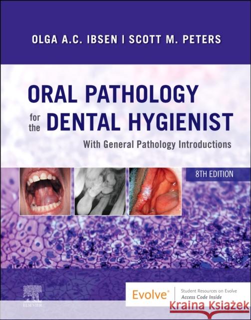 Oral Pathology for the Dental Hygienist Olga A. C. Ibsen Scott Peters 9780323764032 Saunders - książka