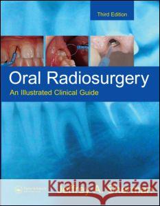Oral Radiosurgery: An Illustrated Clinical Guide Jeffrey A. Sherman 9781841844619 Taylor & Francis Group - książka