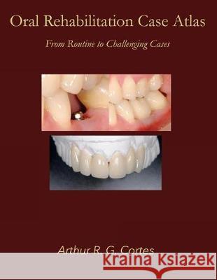 Oral Rehabilitation Case Atlas: From Routine to Challenging Cases Arthur R. G. Cortes 9781974427000 Createspace Independent Publishing Platform - książka