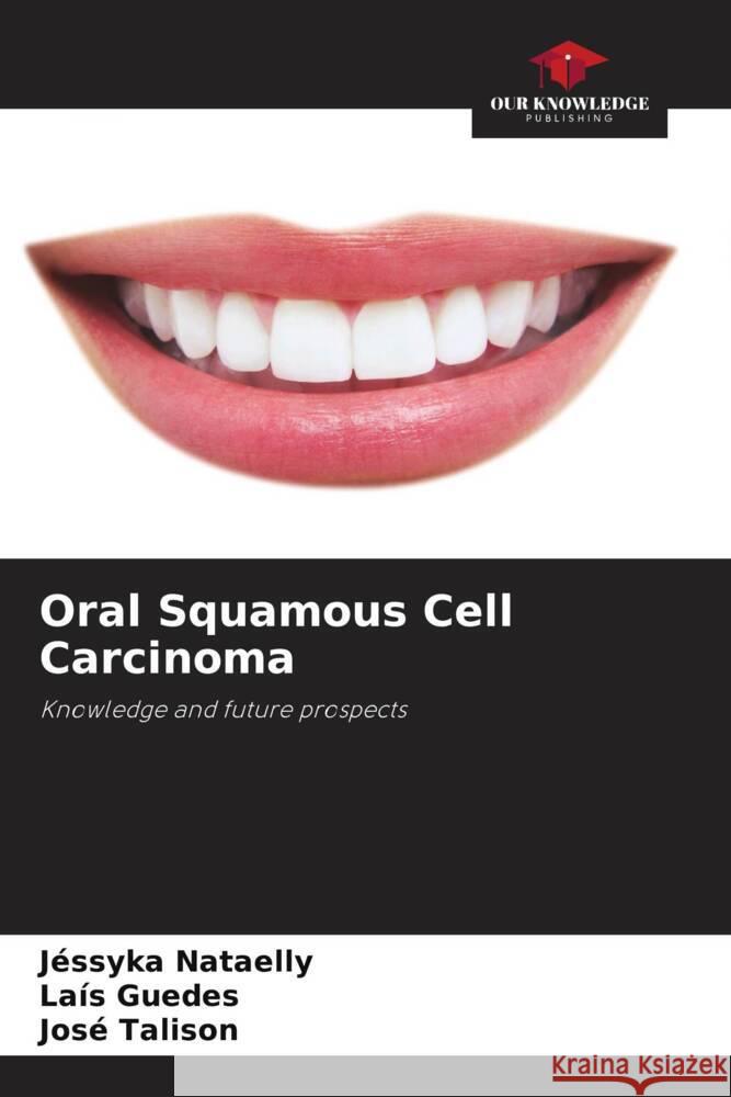 Oral Squamous Cell Carcinoma Nataelly, Jéssyka, Guedes, Laís, Talison, José 9786206441700 Our Knowledge Publishing - książka